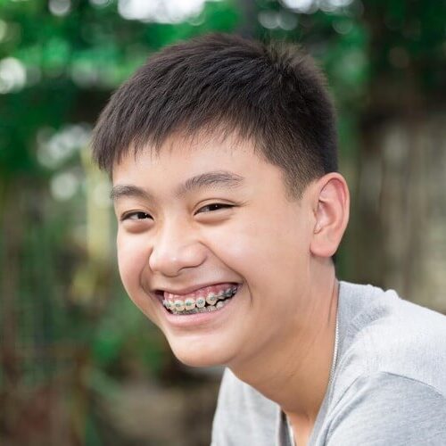 A teenage boy smiling with braces on his teeth after an orthodontic appointment